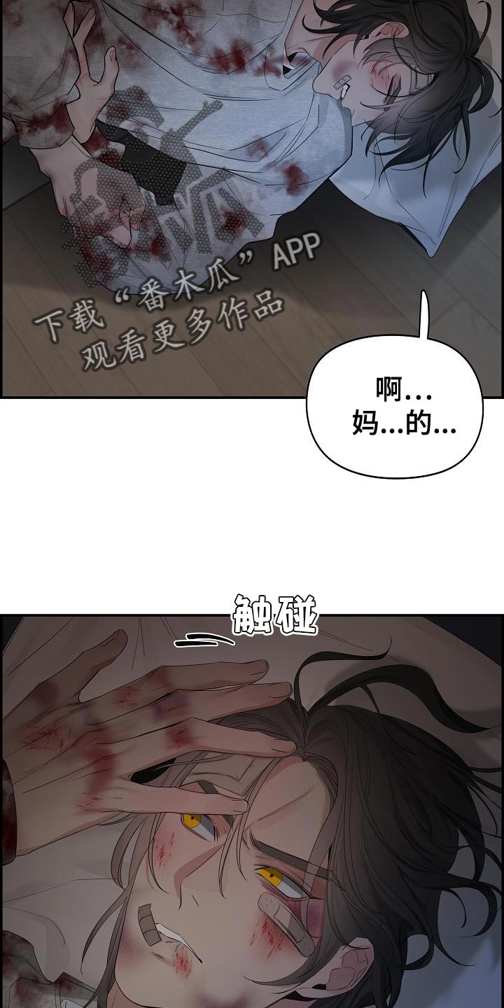 第87话17