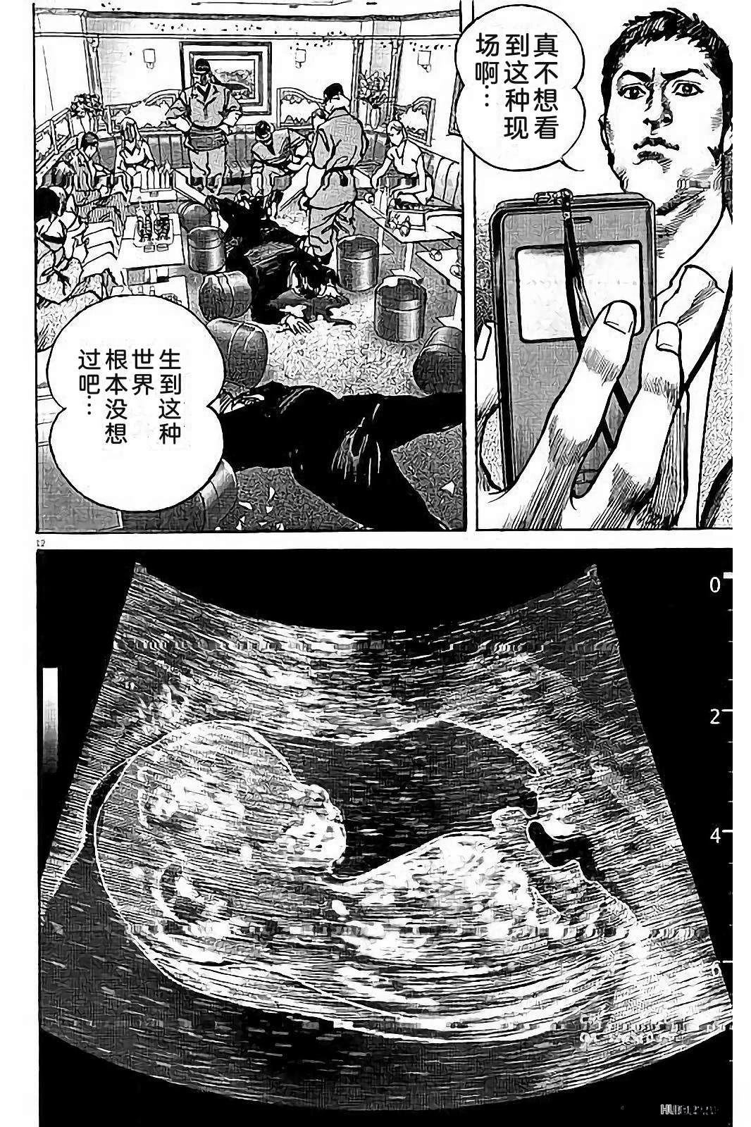 第1卷159