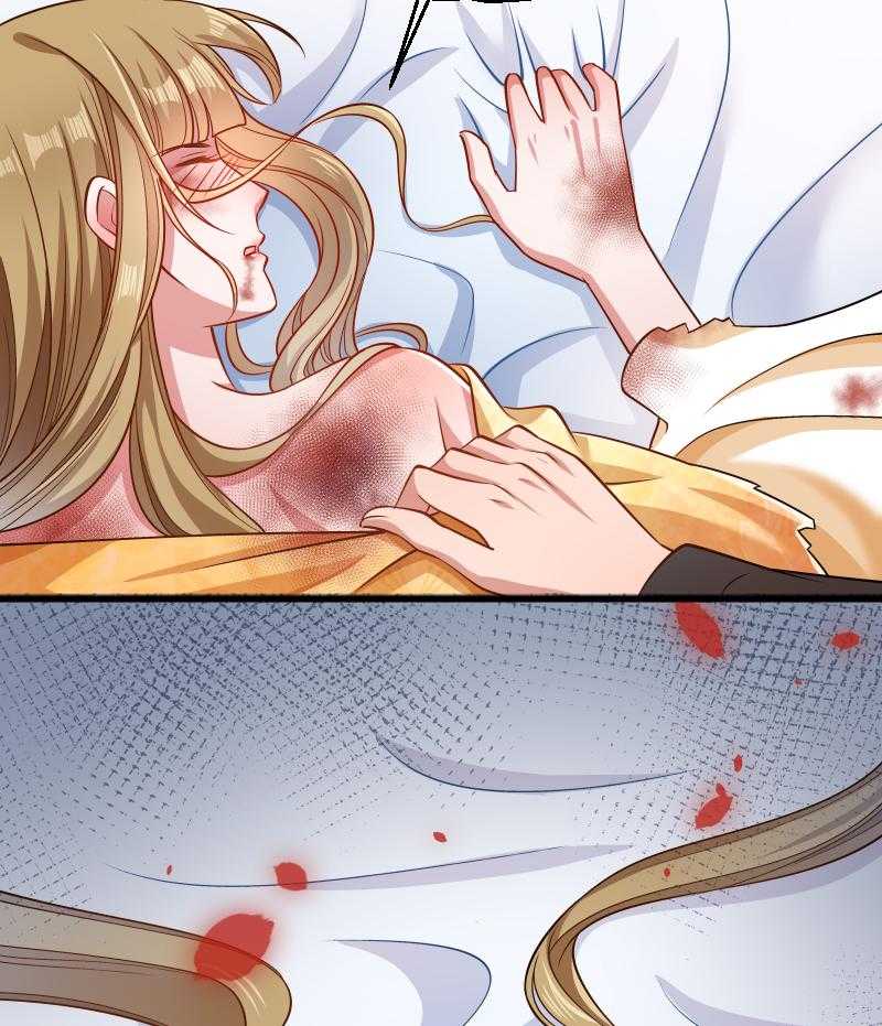 第52话_触目惊心的伤痕42