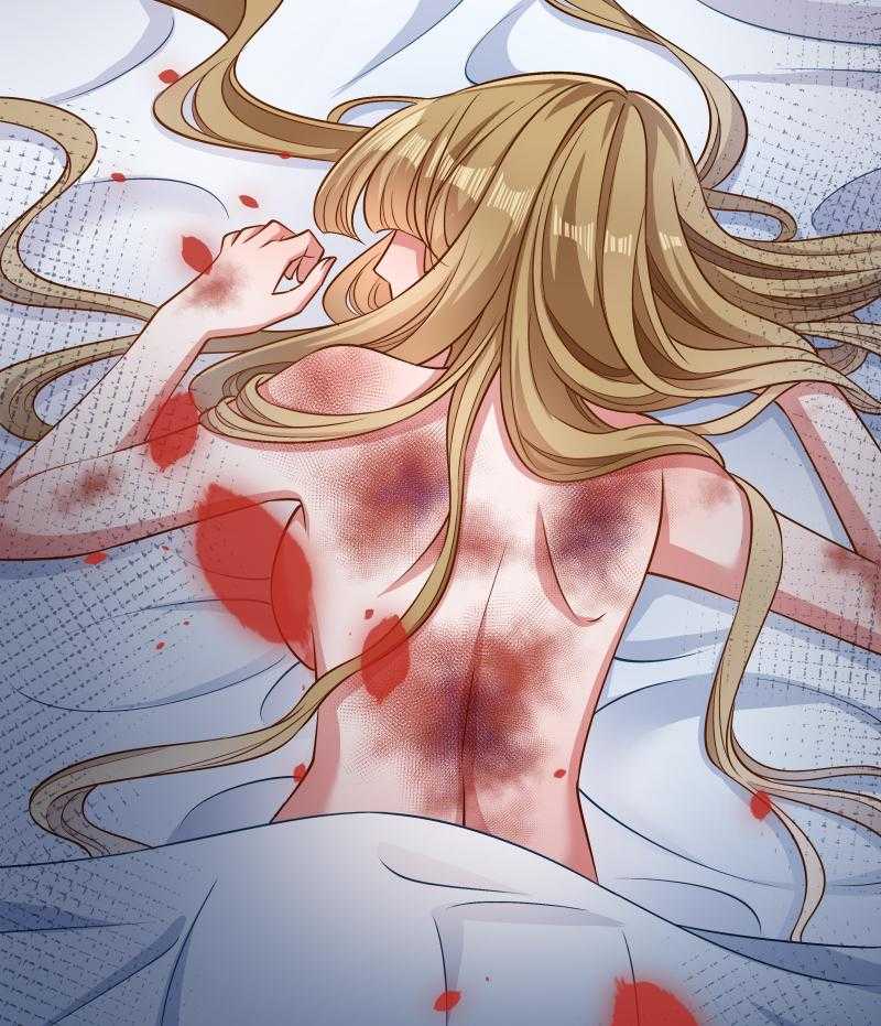 第52话_触目惊心的伤痕43