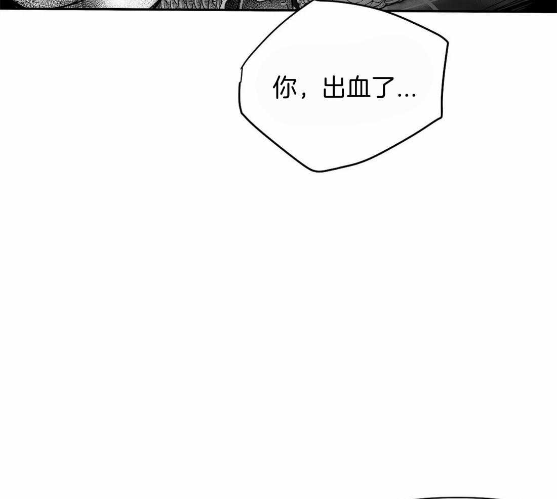 第115话_对不起受伤了17
