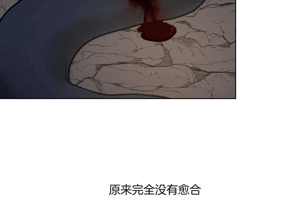 第67话_重伤未愈44