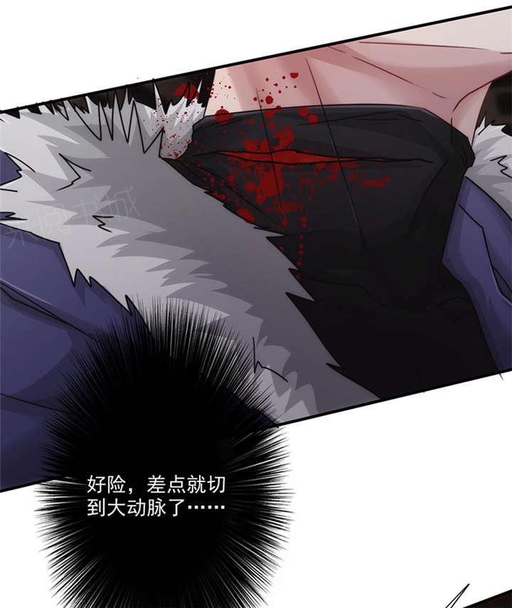 第144话13